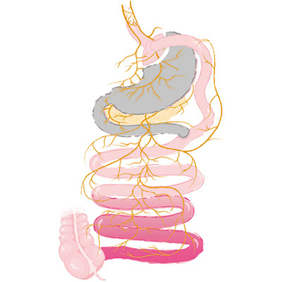 Gastric bypass alone