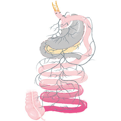 Truncal vagotomy in combination with gastric bypass
